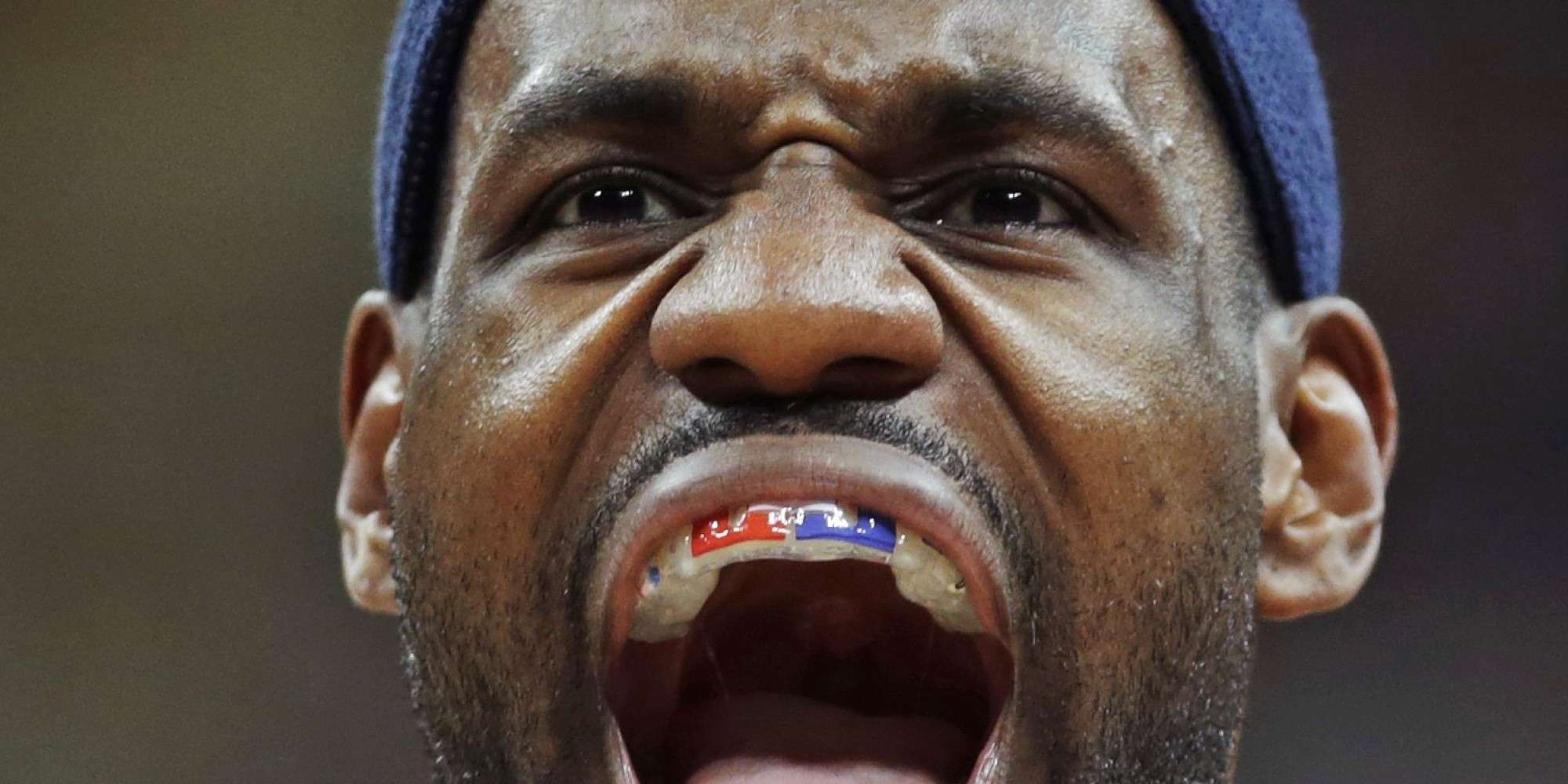 lebron james dientes