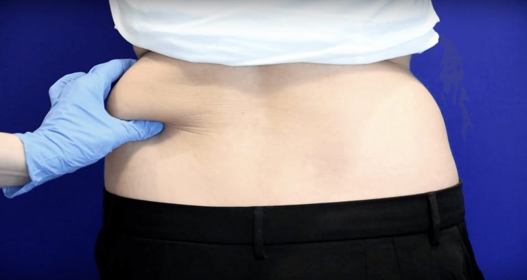 Consejos para Eliminar grasa localizada