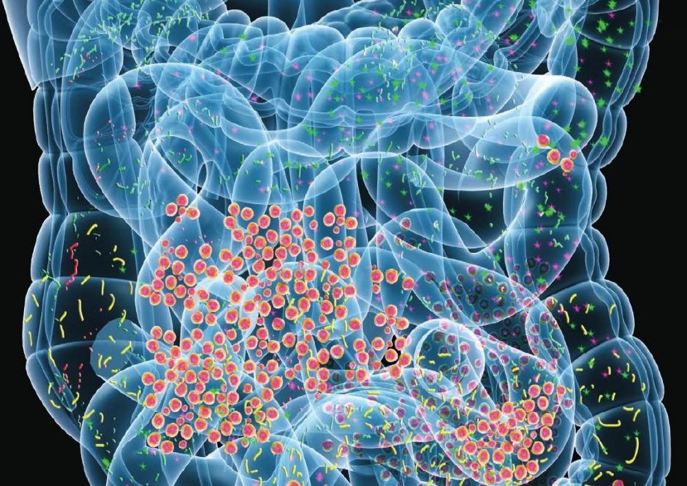 Disbiosis Intestinal en el sistema digestivo