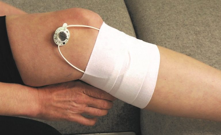 mejoran sus lesiones con Actipatch