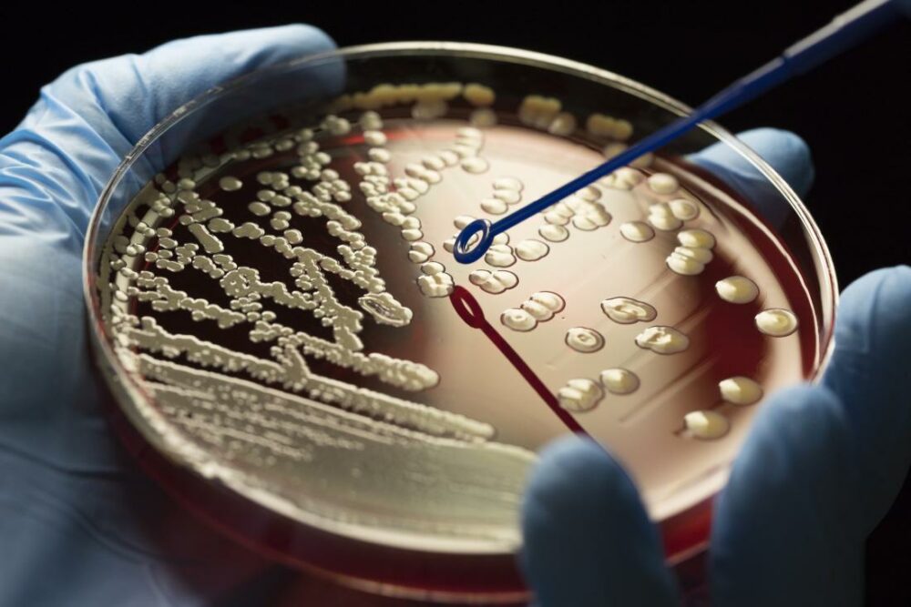 Bacterias resistentes por el abuso de los antibióticos