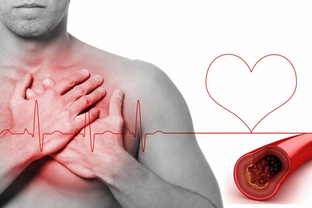 Hipercolesterolemia familiar genética: qué es y consejos para controlarla