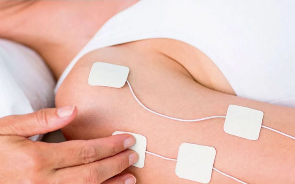 Electroestimuladores para tonificar los brazos