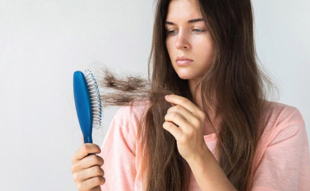 alopecia, una de las secuelas más frecuentes que la COVID19 puede producir