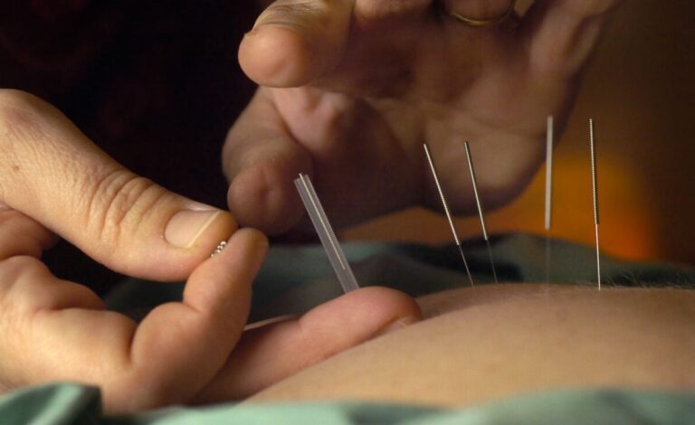 acupuntura en el tratamiento del dolor y lesiones musculares