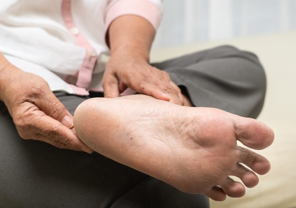 qué es la osteoartritis